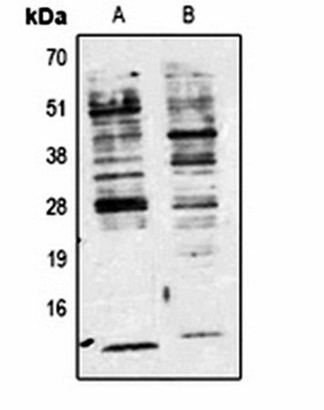 Western blot analysis of Jurkat (Lane 1), 293T (Lane 2) whole cell lysates using Phosphotyrosine antibody