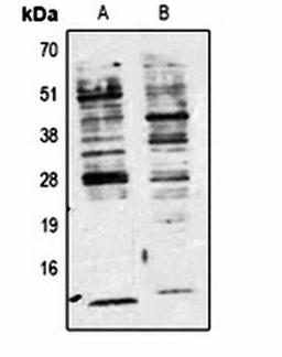 Western blot analysis of Jurkat (Lane 1), 293T (Lane 2) whole cell lysates using Phosphotyrosine antibody