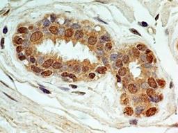 Immunohistochemistry-Paraffin: NALP6 Antibody [NBP2-31372] - IHC-P analysis of NALP6 protein in a section of human breast normal tissue using NALP6 antibody at a concentration of 5 ug/ml. The breast ductal /acinar epithelium showed a strong NALP6 positivity in the cytoplasm and nuclei of the cells.