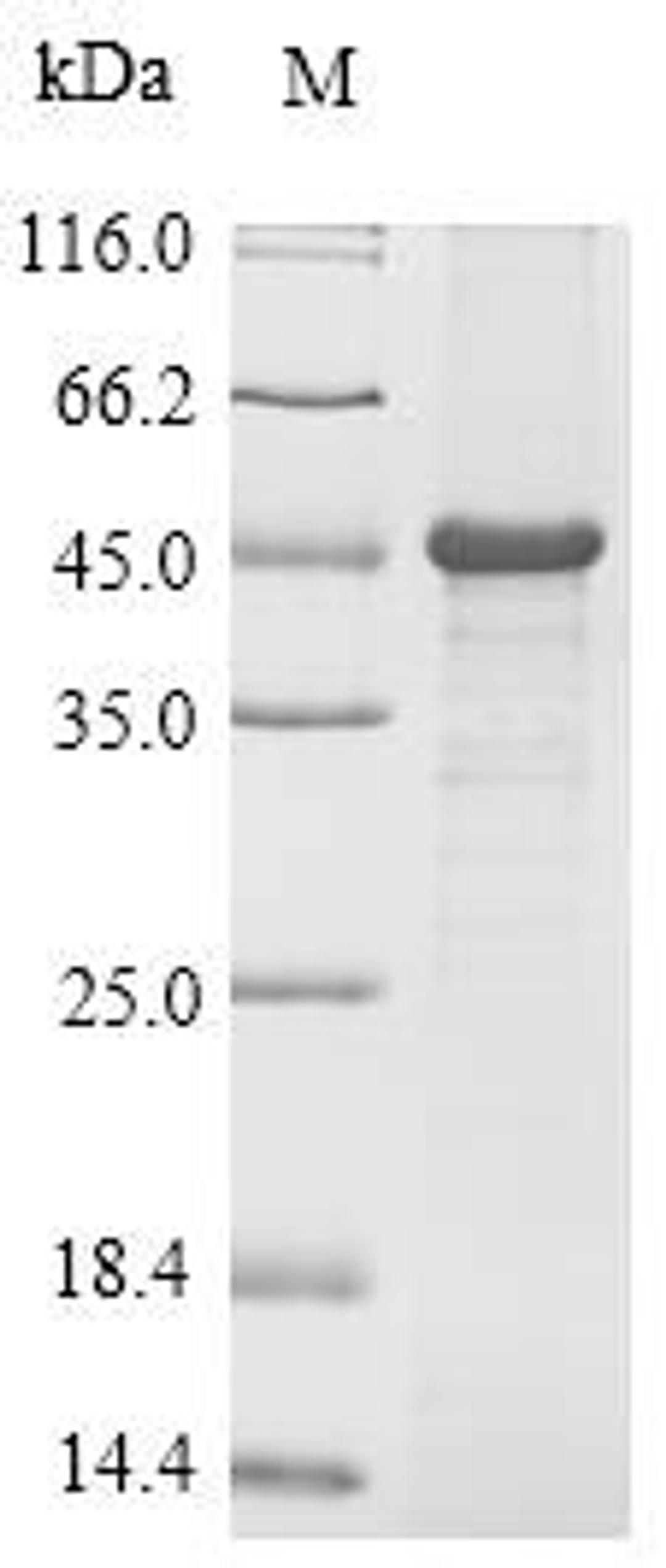 (Tris-Glycine gel) Discontinuous SDS-PAGE (reduced) with 5% enrichment gel and 15% separation gel.