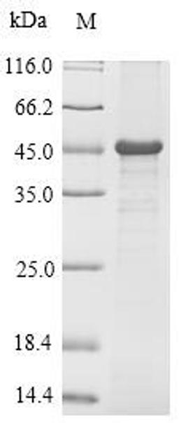 (Tris-Glycine gel) Discontinuous SDS-PAGE (reduced) with 5% enrichment gel and 15% separation gel.