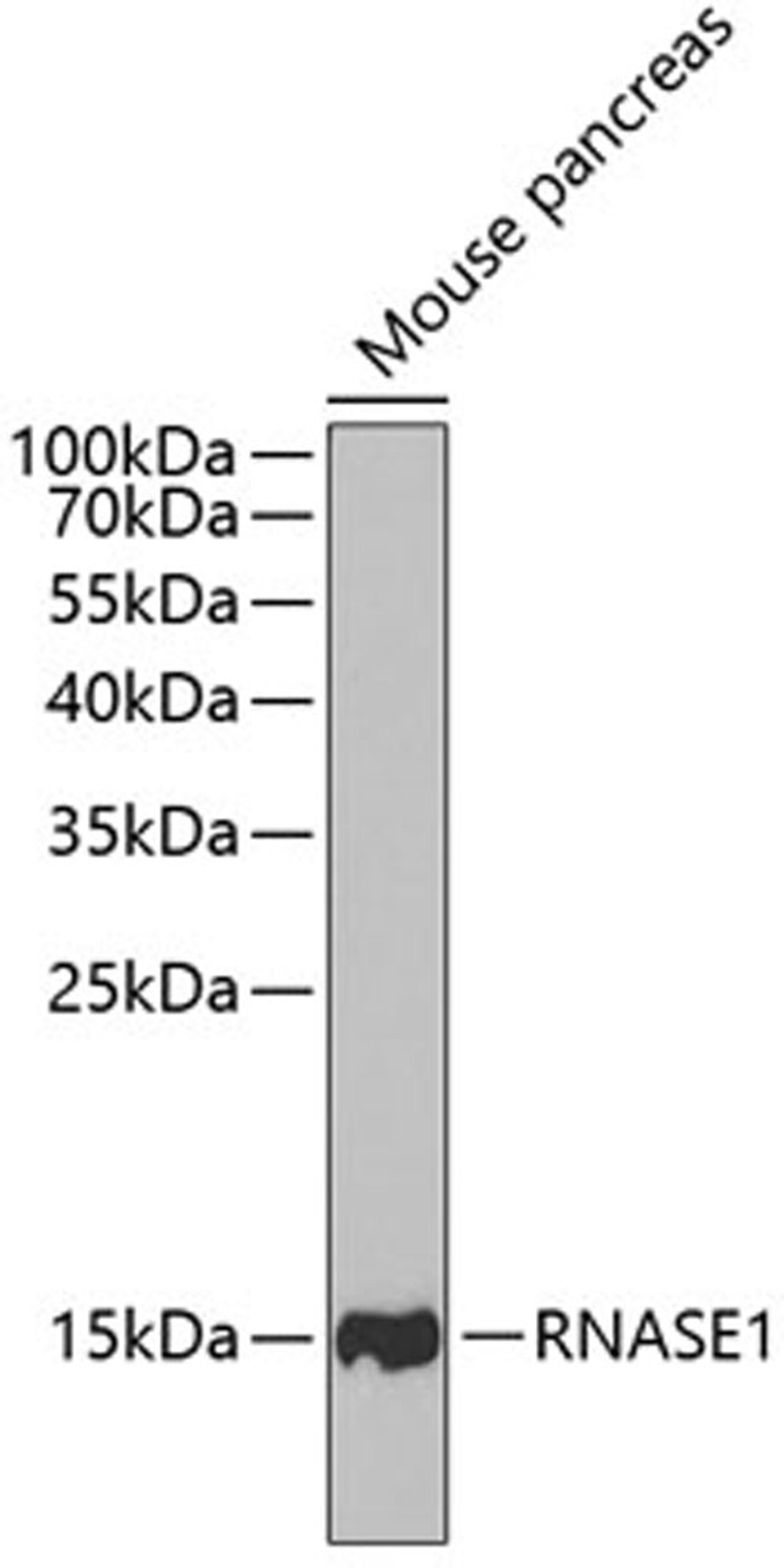 Western blot - RNASE1 antibody (A6202)