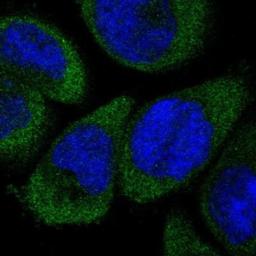 Immunofluorescence: Dfna5 deafness Antibody [NBP1-87689] - Immunofluorescent staining of human cell line A-431 shows positivity in cytoplasm.