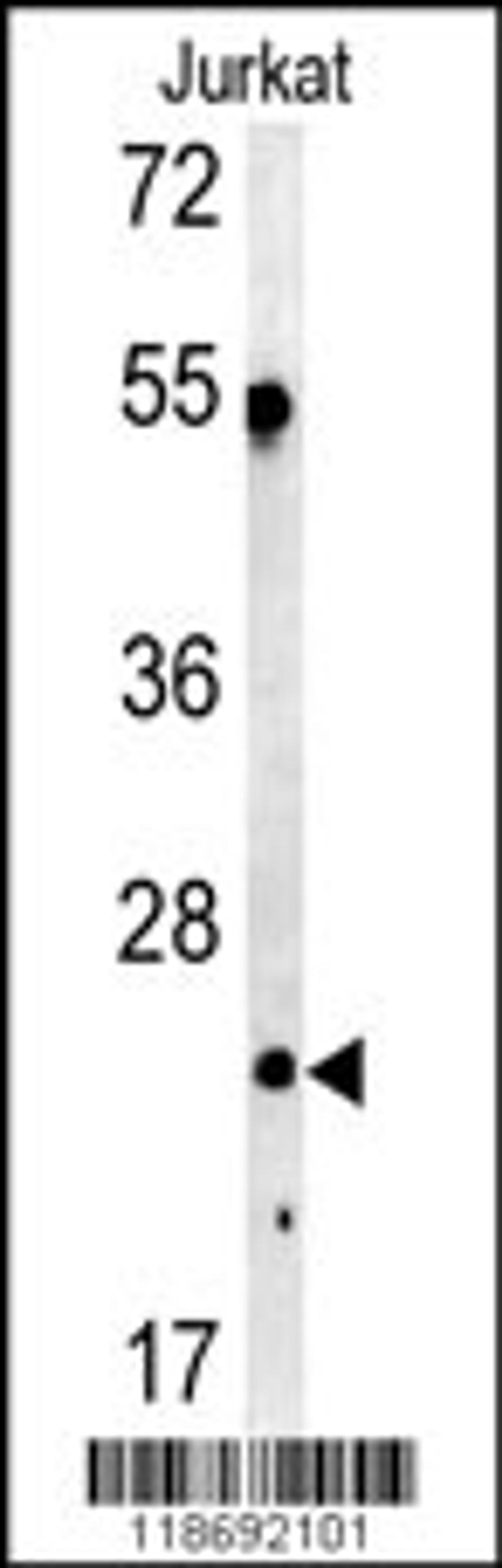 Western blot analysis of C1QA antibody in Jurkat cell line lysates (35ug/lane)