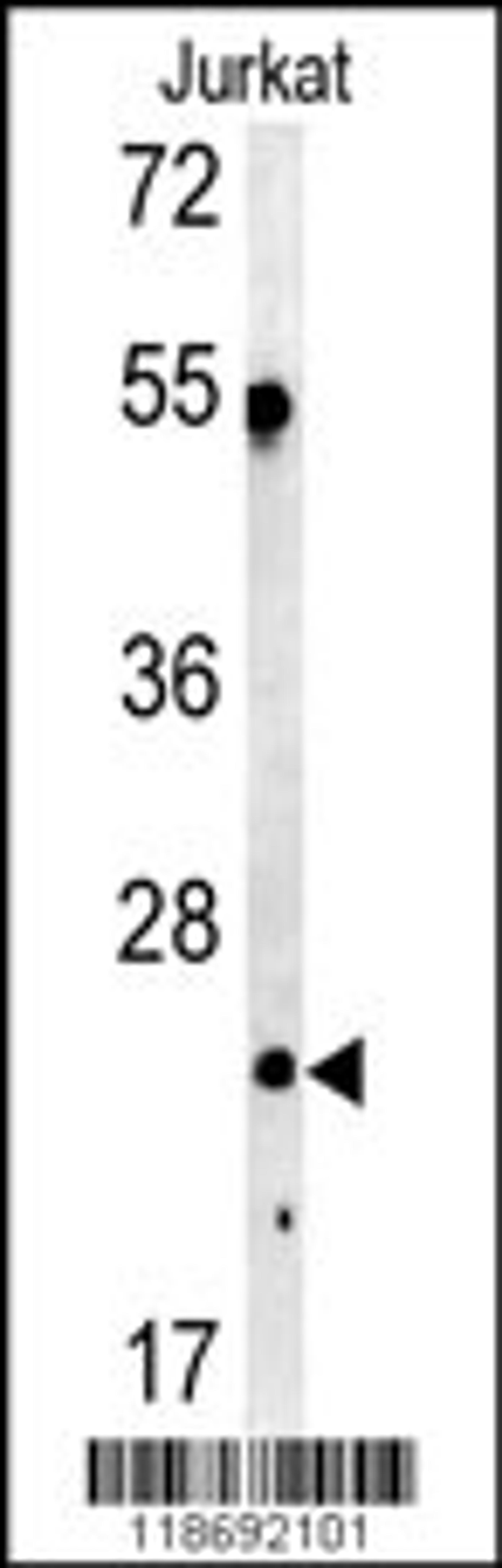 Western blot analysis of C1QA antibody in Jurkat cell line lysates (35ug/lane)