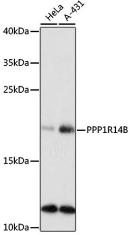 Western blot - PPP1R14B antibody (A14677)