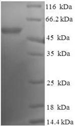 (Tris-Glycine gel) Discontinuous SDS-PAGE (reduced) with 5% enrichment gel and 15% separation gel.