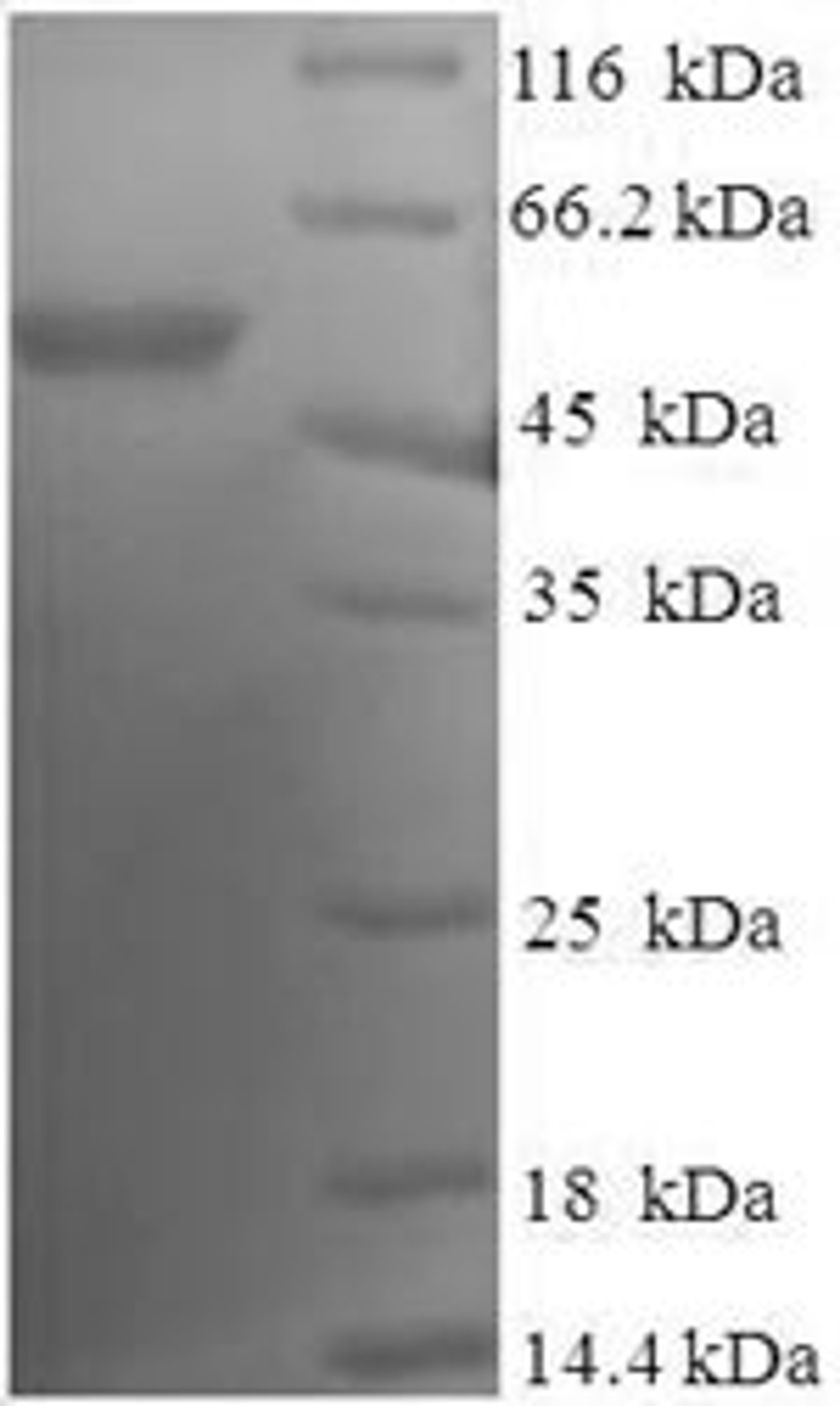 (Tris-Glycine gel) Discontinuous SDS-PAGE (reduced) with 5% enrichment gel and 15% separation gel.