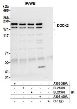 Detection of human DOCK2 by western blot of immunoprecipitates.