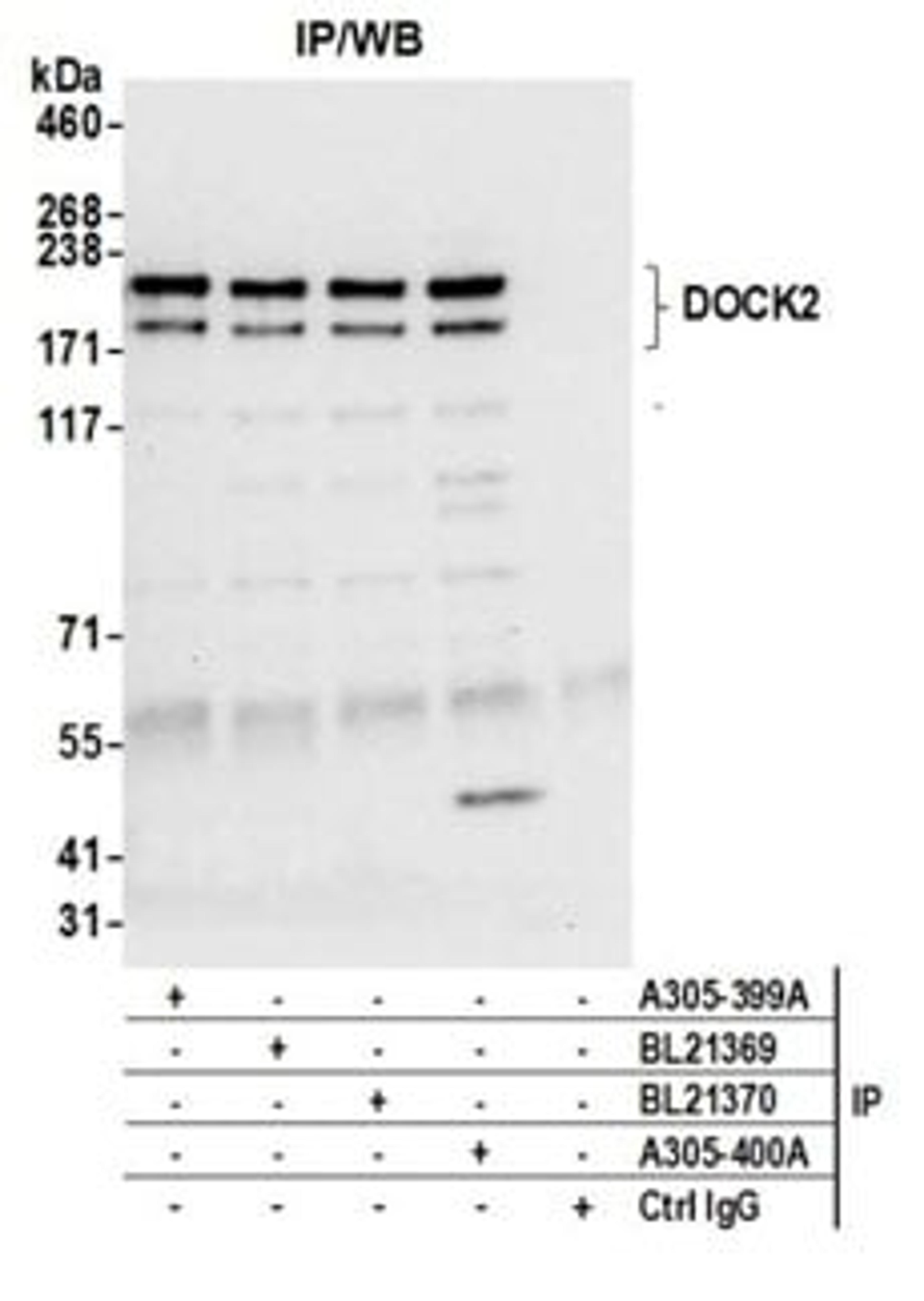 Detection of human DOCK2 by western blot of immunoprecipitates.