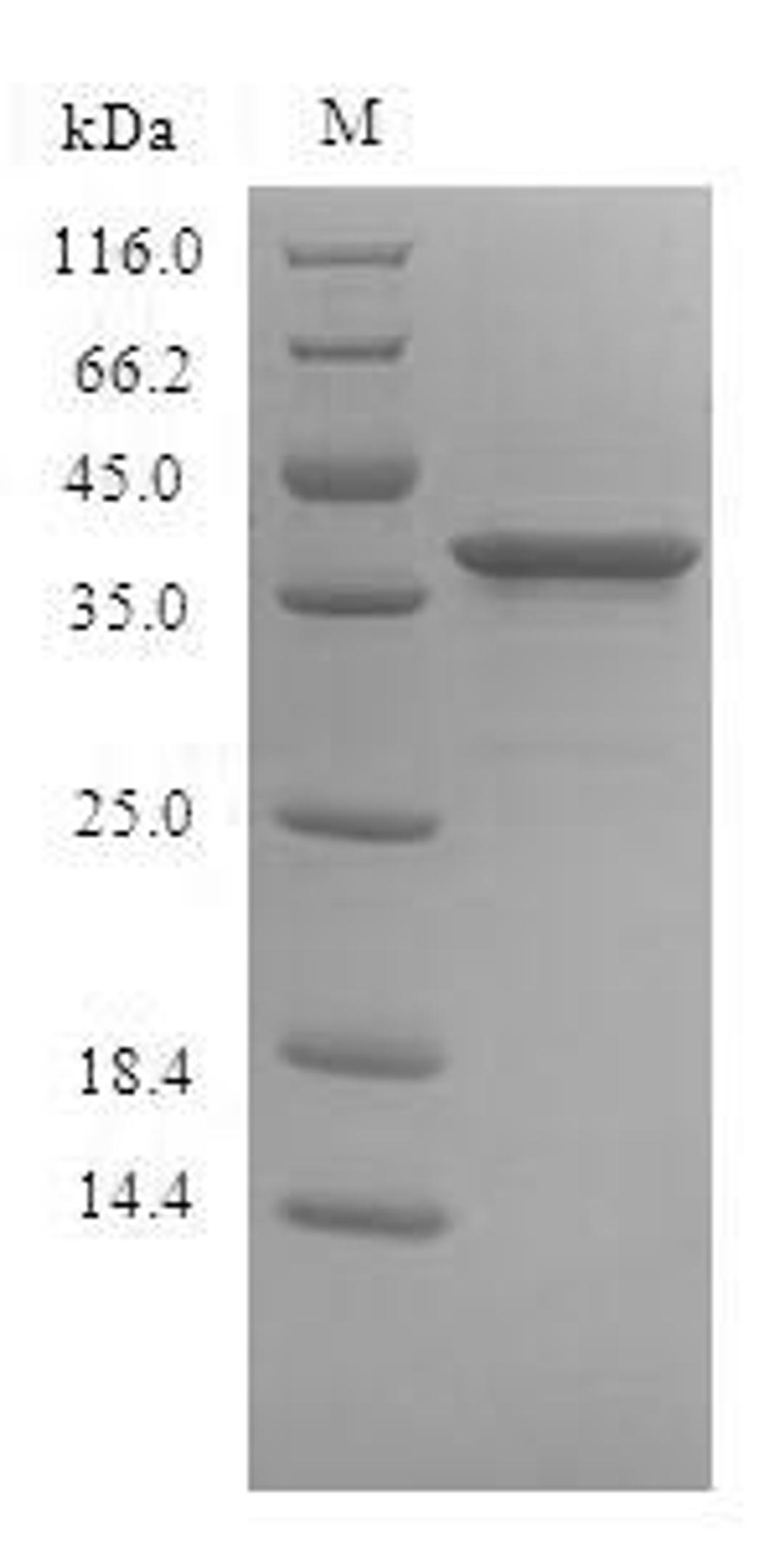 (Tris-Glycine gel) Discontinuous SDS-PAGE (reduced) with 5% enrichment gel and 15% separation gel.