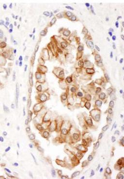 Detection of human ABCB9 by immunohistochemistry.