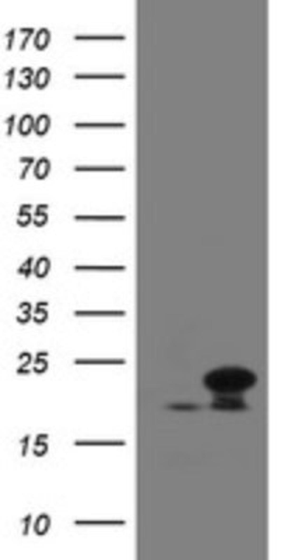 Western Blot: NDUFB10 Antibody (1H6) [NBP2-46118] - Analysis of HEK293T cells were transfected with the pCMV6-ENTRY control (Left lane) or pCMV6-ENTRY NDUFB10.