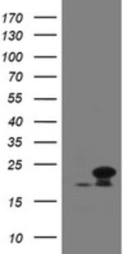 Western Blot: NDUFB10 Antibody (1H6) [NBP2-46118] - Analysis of HEK293T cells were transfected with the pCMV6-ENTRY control (Left lane) or pCMV6-ENTRY NDUFB10.