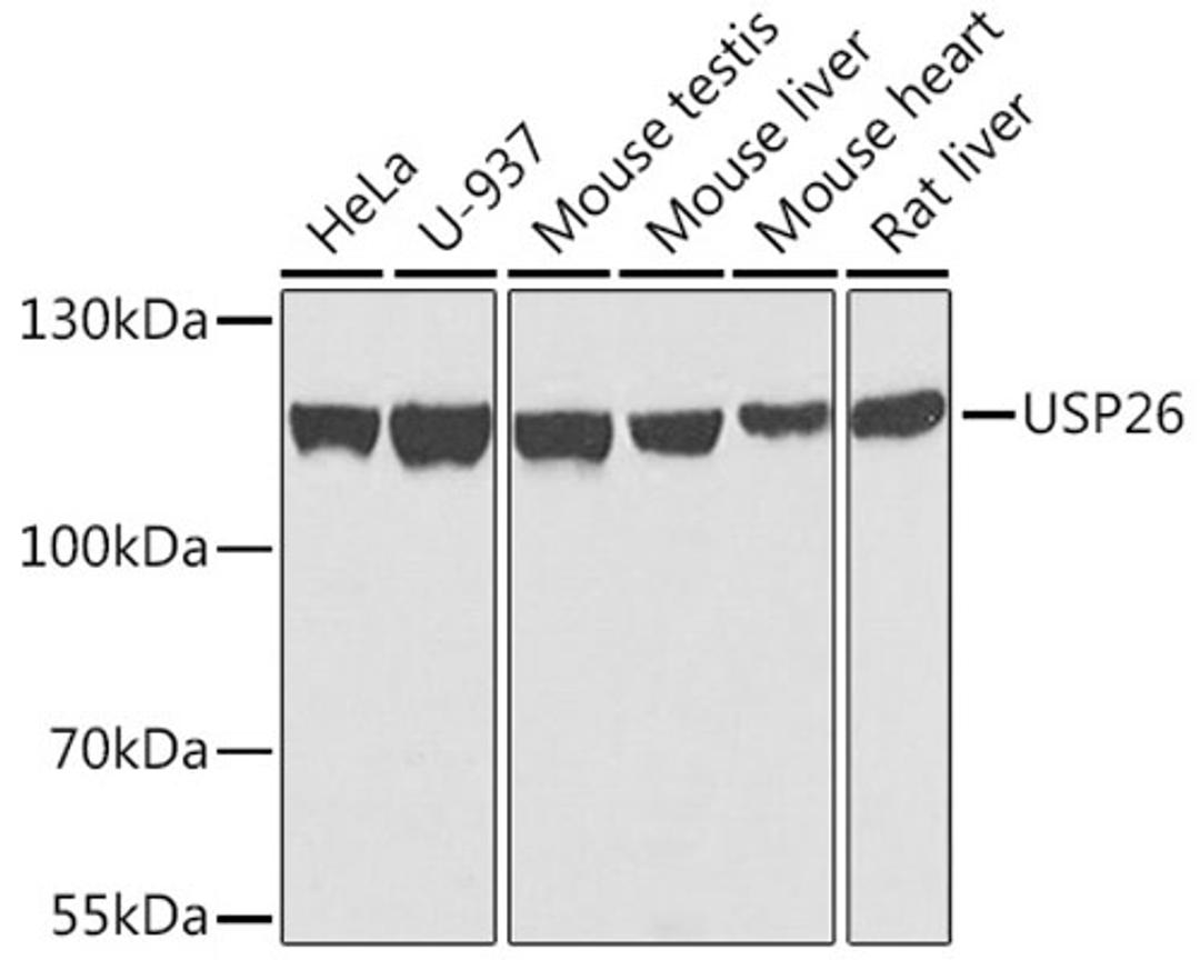 Western blot - USP26 antibody (A7999)