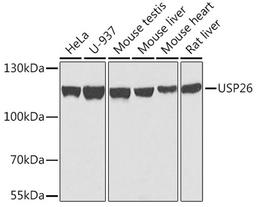 Western blot - USP26 antibody (A7999)