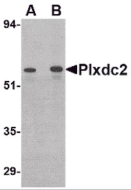 Western blot analysis of Plxdc2 in human colon tissue lysate with Plxdc2 antibody at (A) 0.5 (B) 1 &#956;g/mL.