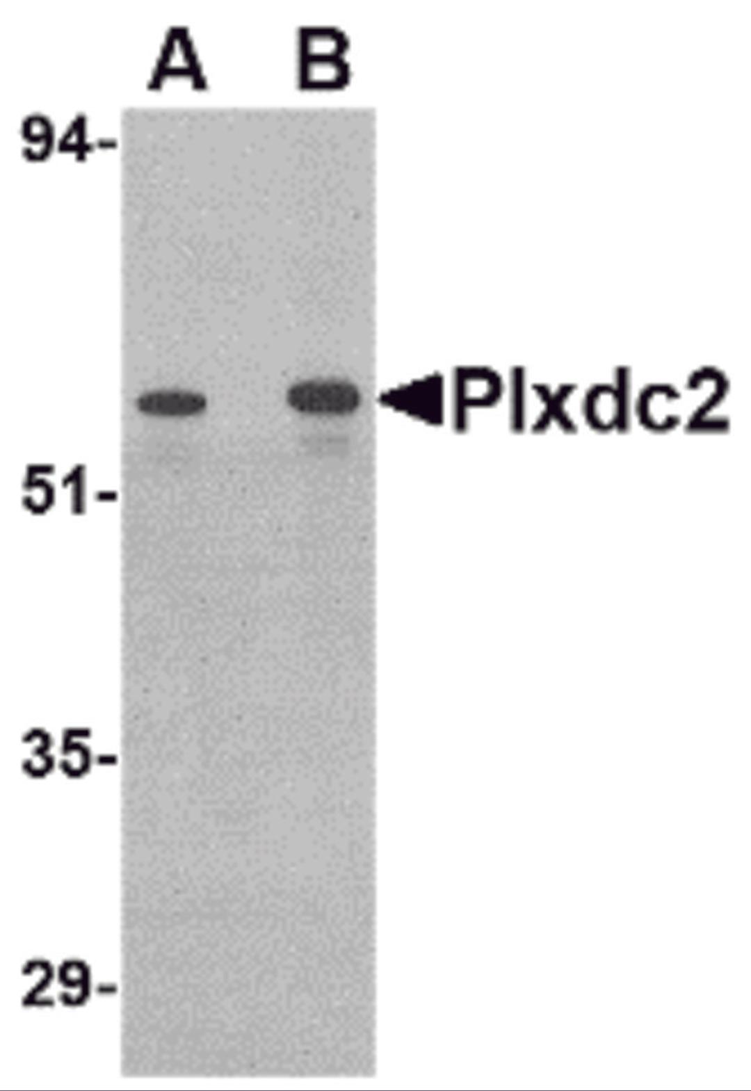 Western blot analysis of Plxdc2 in human colon tissue lysate with Plxdc2 antibody at (A) 0.5 (B) 1 μg/mL.
