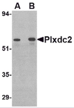 Western blot analysis of Plxdc2 in human colon tissue lysate with Plxdc2 antibody at (A) 0.5 (B) 1 μg/mL.