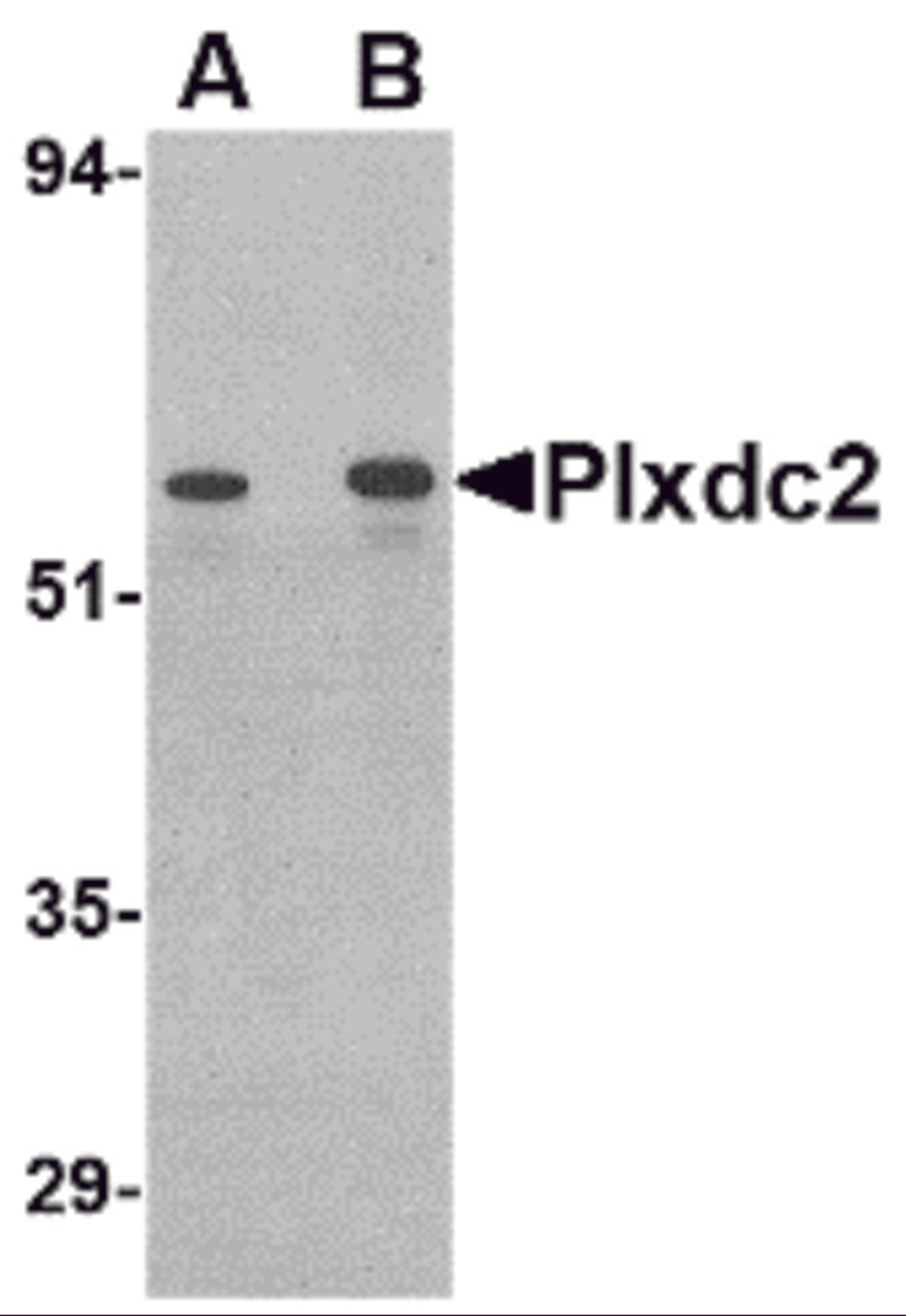 Western blot analysis of Plxdc2 in human colon tissue lysate with Plxdc2 antibody at (A) 0.5 (B) 1 μg/mL.
