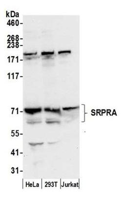 Detection of human SRPRA by western blot.