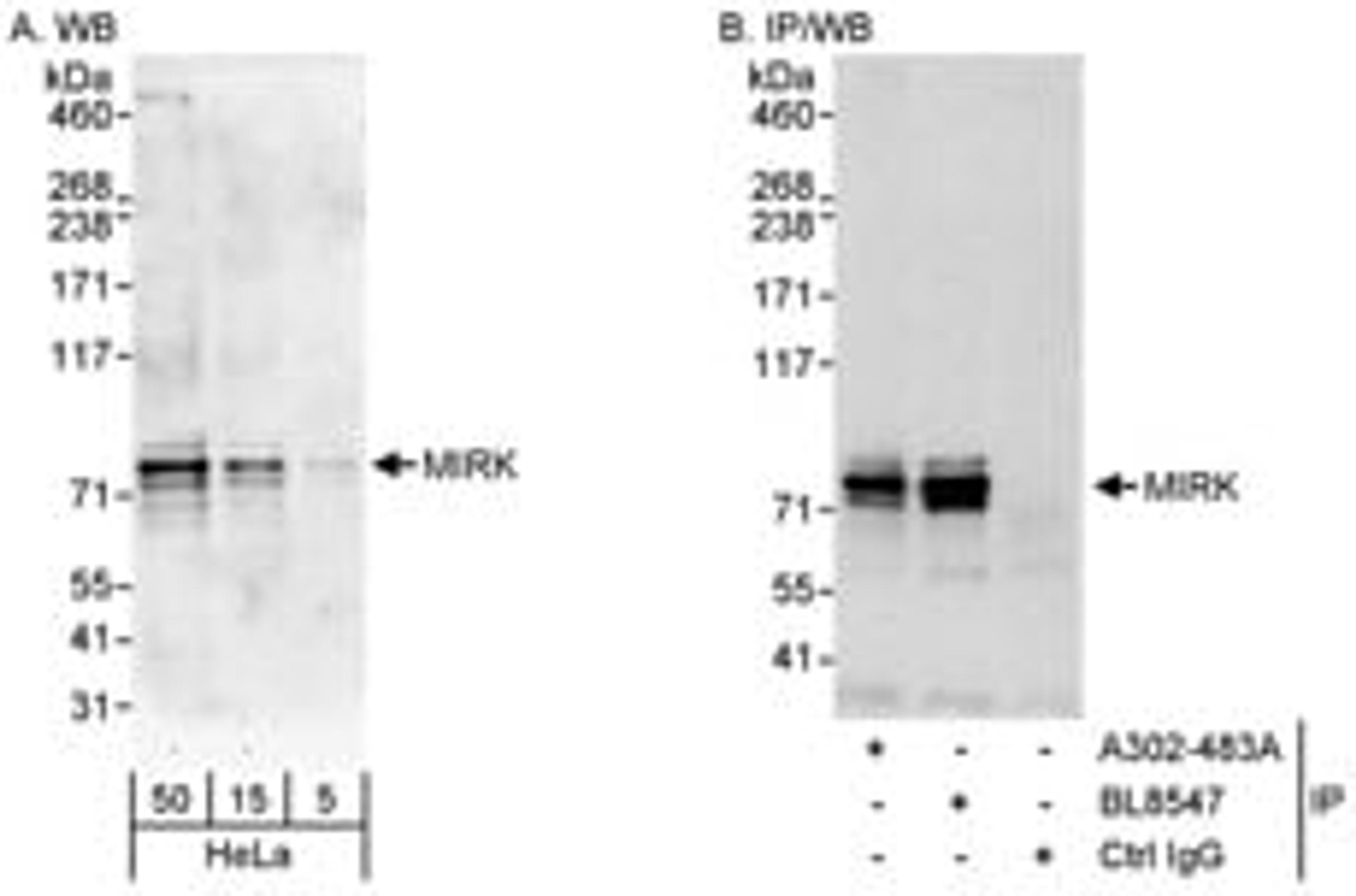 Detection of human MIRK by western blot and immunoprecipitation.