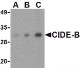 Western blot analysis of CIDE-B in mouse small intestine tissue lysate with CIDE-B antibody at (A) 0.5, (B) 1 and (C) 2 &#956;g/mL.