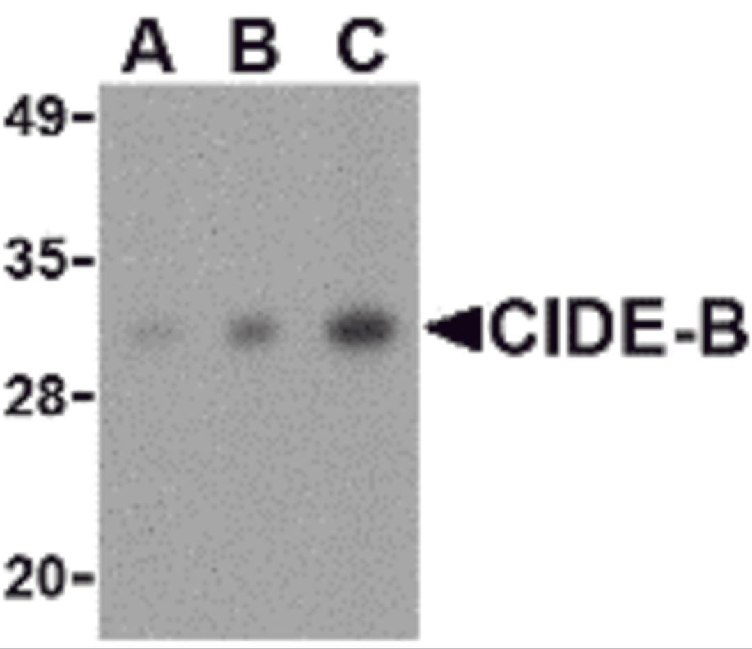 Western blot analysis of CIDE-B in mouse small intestine tissue lysate with CIDE-B antibody at (A) 0.5, (B) 1 and (C) 2 μg/mL.