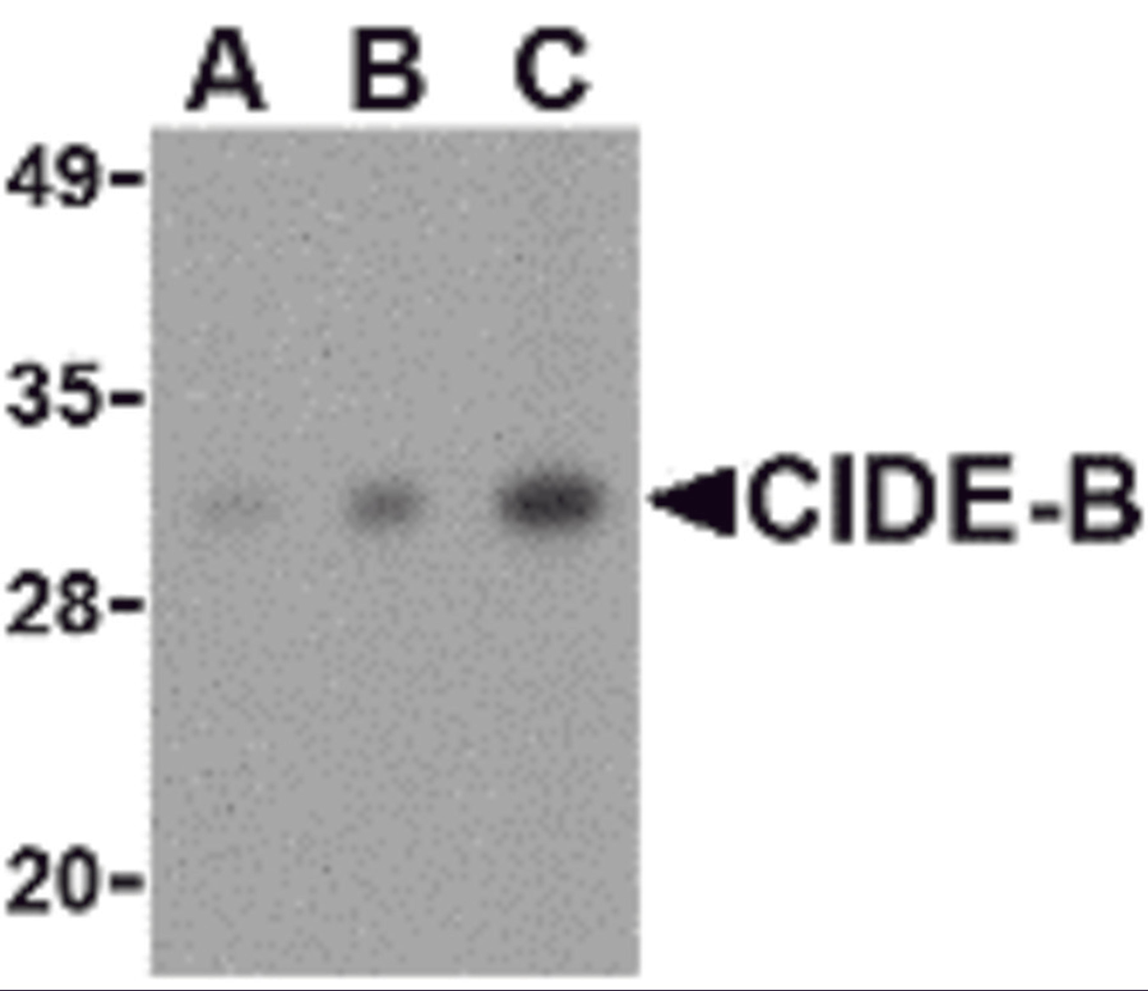 Western blot analysis of CIDE-B in mouse small intestine tissue lysate with CIDE-B antibody at (A) 0.5, (B) 1 and (C) 2 μg/mL.