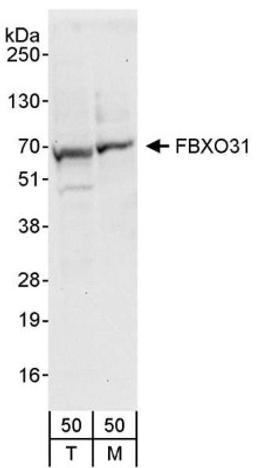 Western Blot: FBXO31 Antibody [NBP1-19088] - Whole cell lysate (50 ug) from 293T (T) and mouse NIH3T3 (M) cells. Antibody used for WB at 0.4 ug/ml.