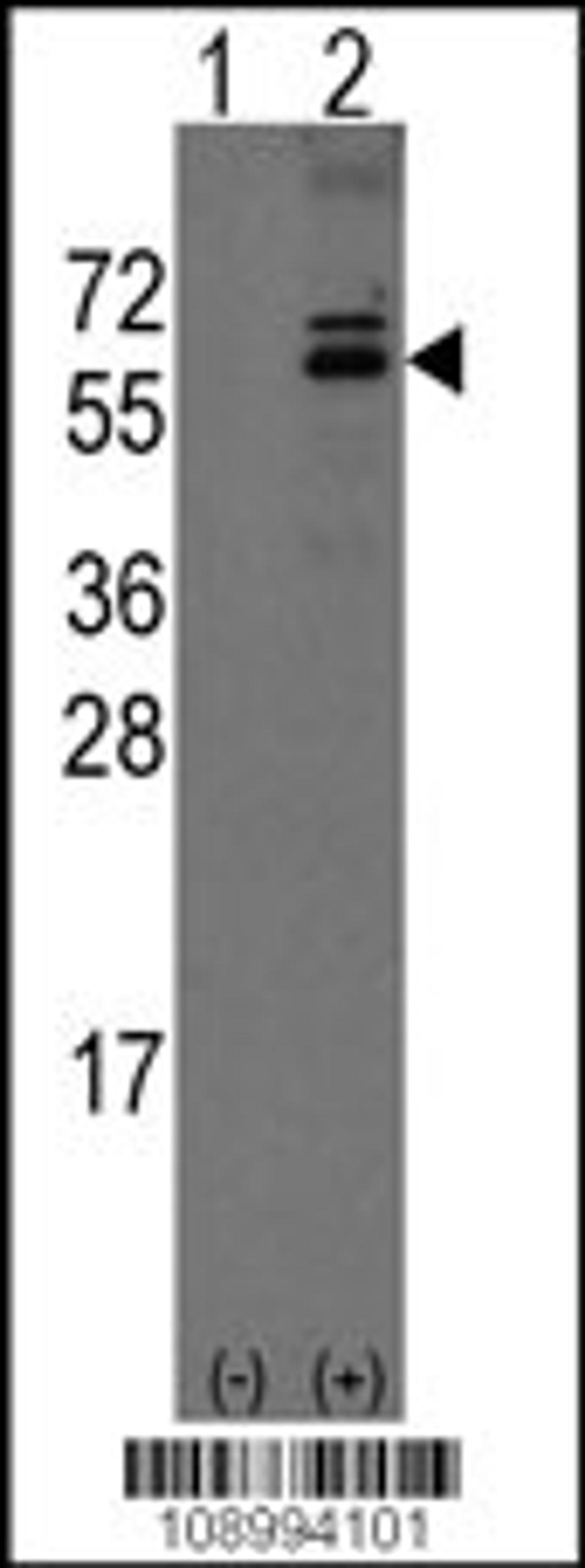 Western blot analysis of Noelin-1(Olfm1) using rabbit polyclonal Noelin-1(Olfm1) Antibody using 293 cell lysates (2 ug/lane) either nontransfected (Lane 1) or transiently transfected with the Noelin-1(Olfm1) gene (Lane 2).