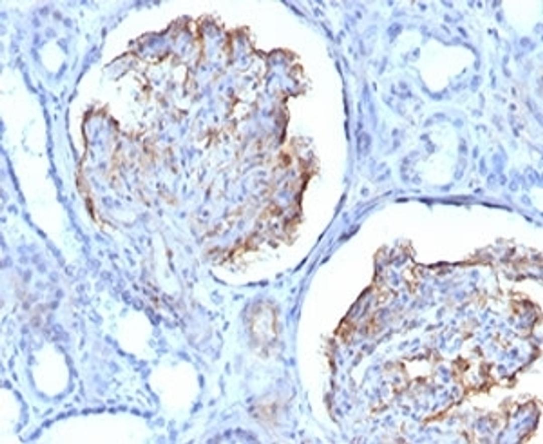 Formalin-fixed, paraffin-embedded human kidney stained with WT1 antibody (clone RMWT1-1).