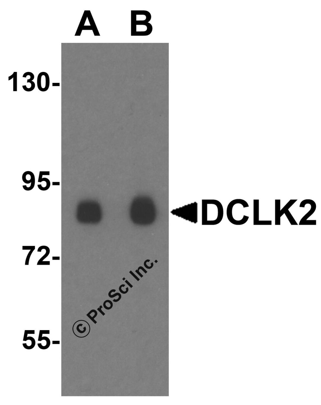 Western blot analysis of DCLK2 in rat brain tissue lysate with DCLK2 antibody at (A) 1 and (B) 2 &#956;g/mL.