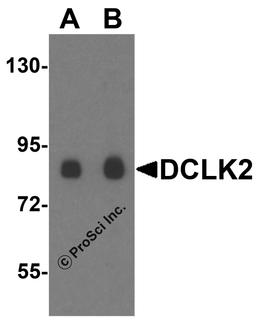 Western blot analysis of DCLK2 in rat brain tissue lysate with DCLK2 antibody at (A) 1 and (B) 2 μg/mL.