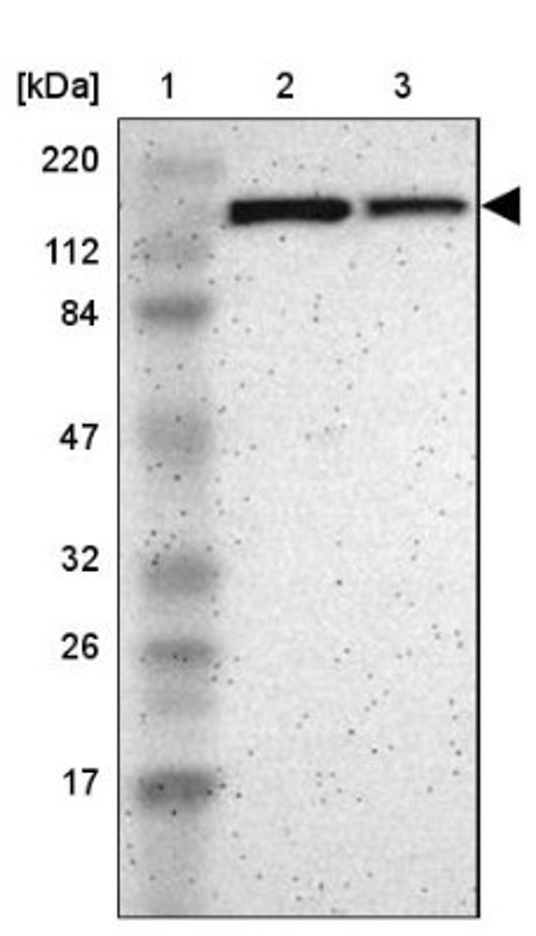 Western Blot: TULP4 Antibody [NBP1-92546] - Lane 1: Marker [kDa] 220, 112, 84, 47, 32, 26, 17<br/>Lane 2: Human cell line RT-4<br/>Lane 3: Human cell line U-251MG sp