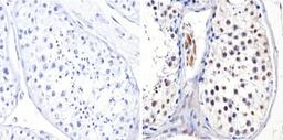 Immunohistochemistry-Paraffin: DNMT3B Antibody [NB300-516] - Analysis showing positive staining in the nucleus of Human testis tissue (right) compared with a negative control in the absence of primary antibody (left).