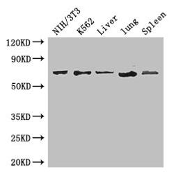 Western Blot. Positive WB detected in: NIH/3T3 whole cell lysate, K562 whole cell lysate, Mouse liver tissue, Mouse lung tissue, Mouse spleen tissue. All lanes: IL23R antibody at 3.4ug/ml. Secondary. Goat polyclonal to rabbit IgG at 1/50000 dilution. Predicted band size: 72, 43, 41, 21, 31, 26 kDa. Observed band size: 72 kDa. 