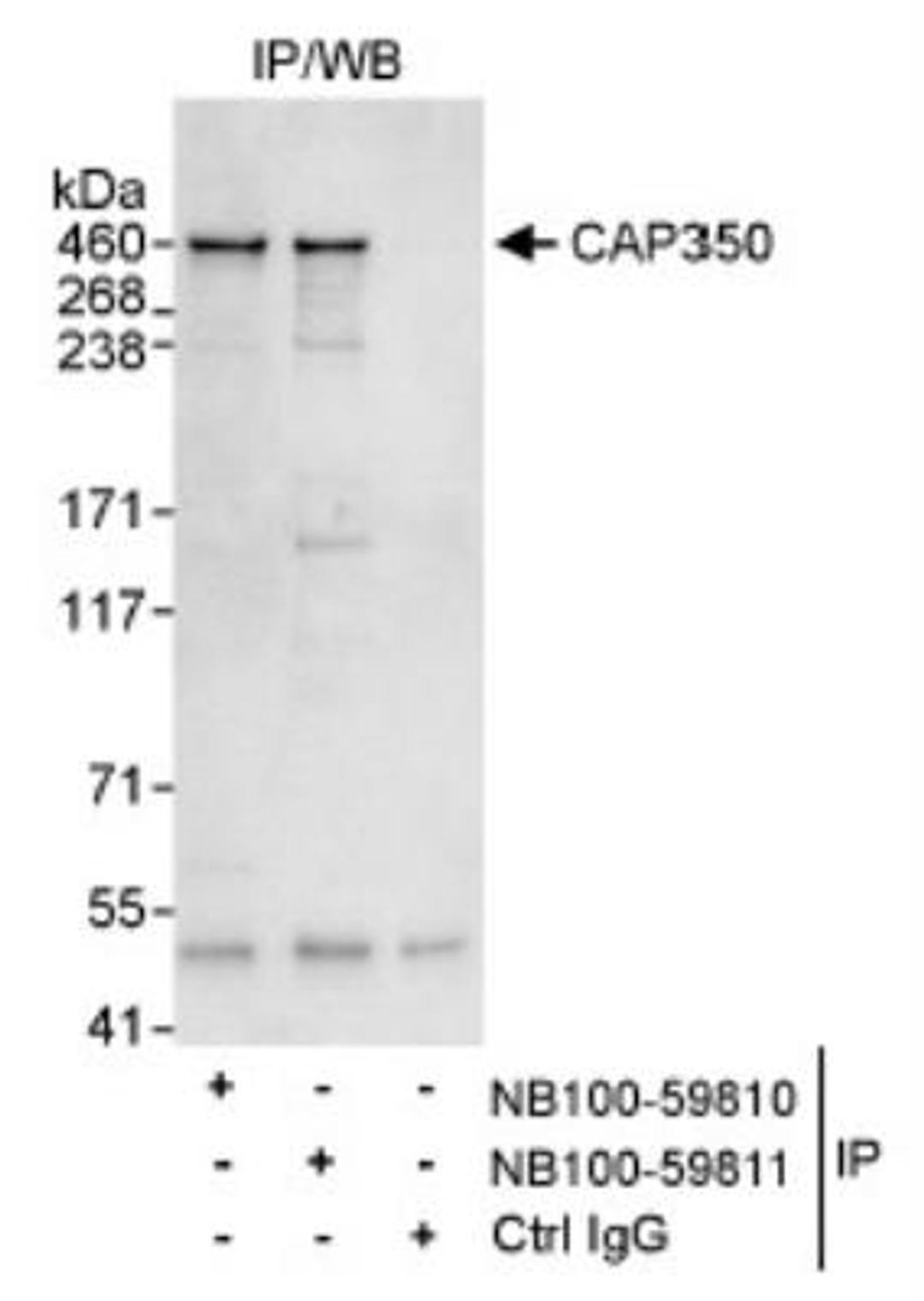 Immunoprecipitation: CEP350 Antibody [NB100-59810] - Detection of Human CAP350 by Western Blot of Immunoprecipitates. Samples: Whole cell lysate (1 mg for IP, 20% of IP loaded) from HeLa cells. Antibodies: Affinity purified rabbit anti-CAP350 antibody NB100-59810 used for IP at 3 mcg/mg lysate. CAP350 was also immunoprecipitated by rabbit anti-CAP350 antibody NB100-59811, which recognizes a downstream epitope.