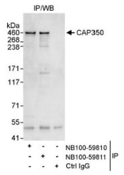 Immunoprecipitation: CEP350 Antibody [NB100-59810] - Detection of Human CAP350 by Western Blot of Immunoprecipitates. Samples: Whole cell lysate (1 mg for IP, 20% of IP loaded) from HeLa cells. Antibodies: Affinity purified rabbit anti-CAP350 antibody NB100-59810 used for IP at 3 mcg/mg lysate. CAP350 was also immunoprecipitated by rabbit anti-CAP350 antibody NB100-59811, which recognizes a downstream epitope.