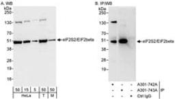 Detection of human and mouse eIF2beta/EIF2S2 by western blot (h&m) and immunoprecipitation (h).