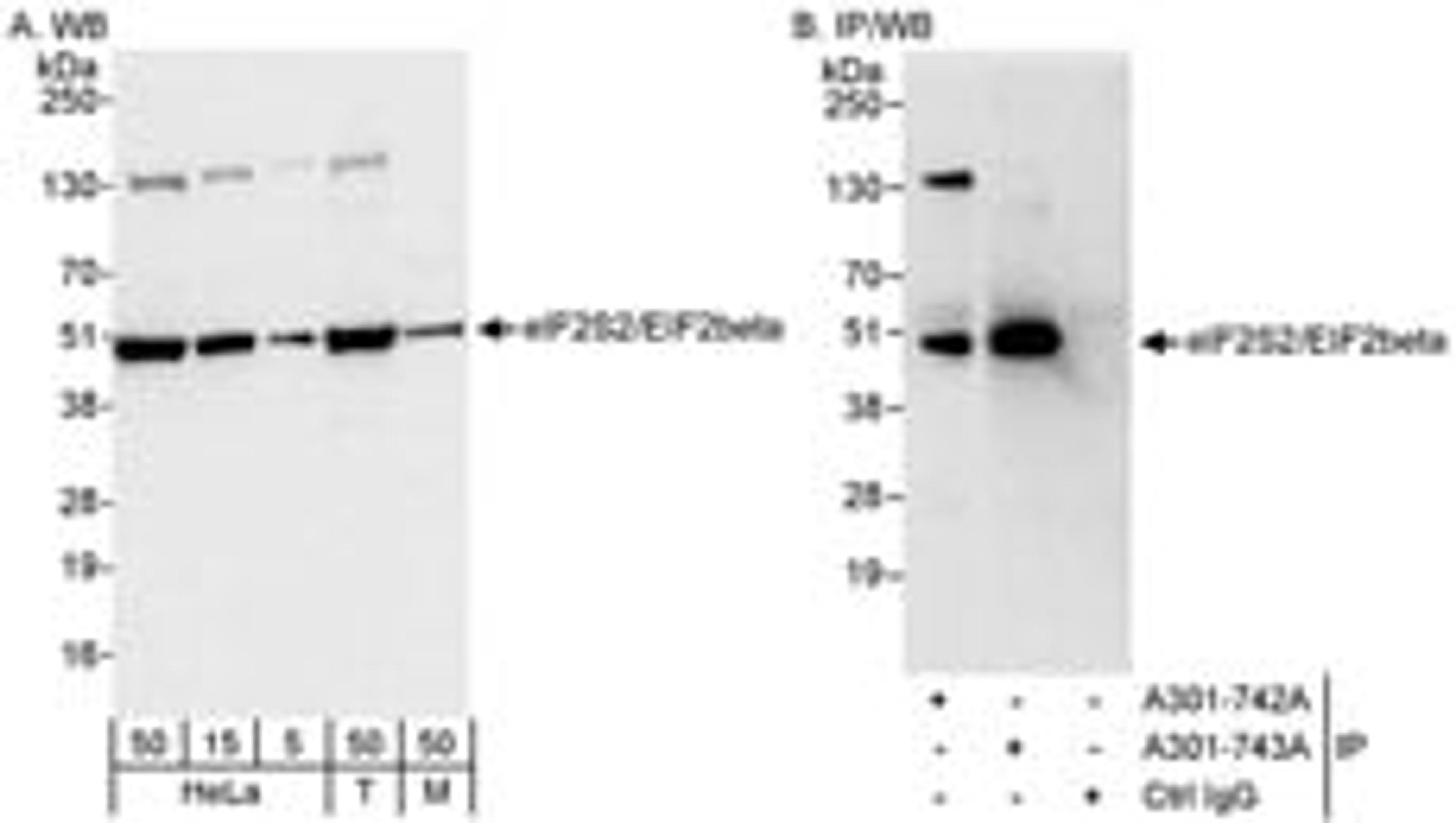 Detection of human and mouse eIF2beta/EIF2S2 by western blot (h&m) and immunoprecipitation (h).