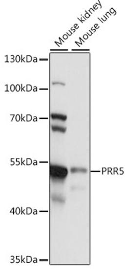 Western blot - PRR5 antibody (A15170)