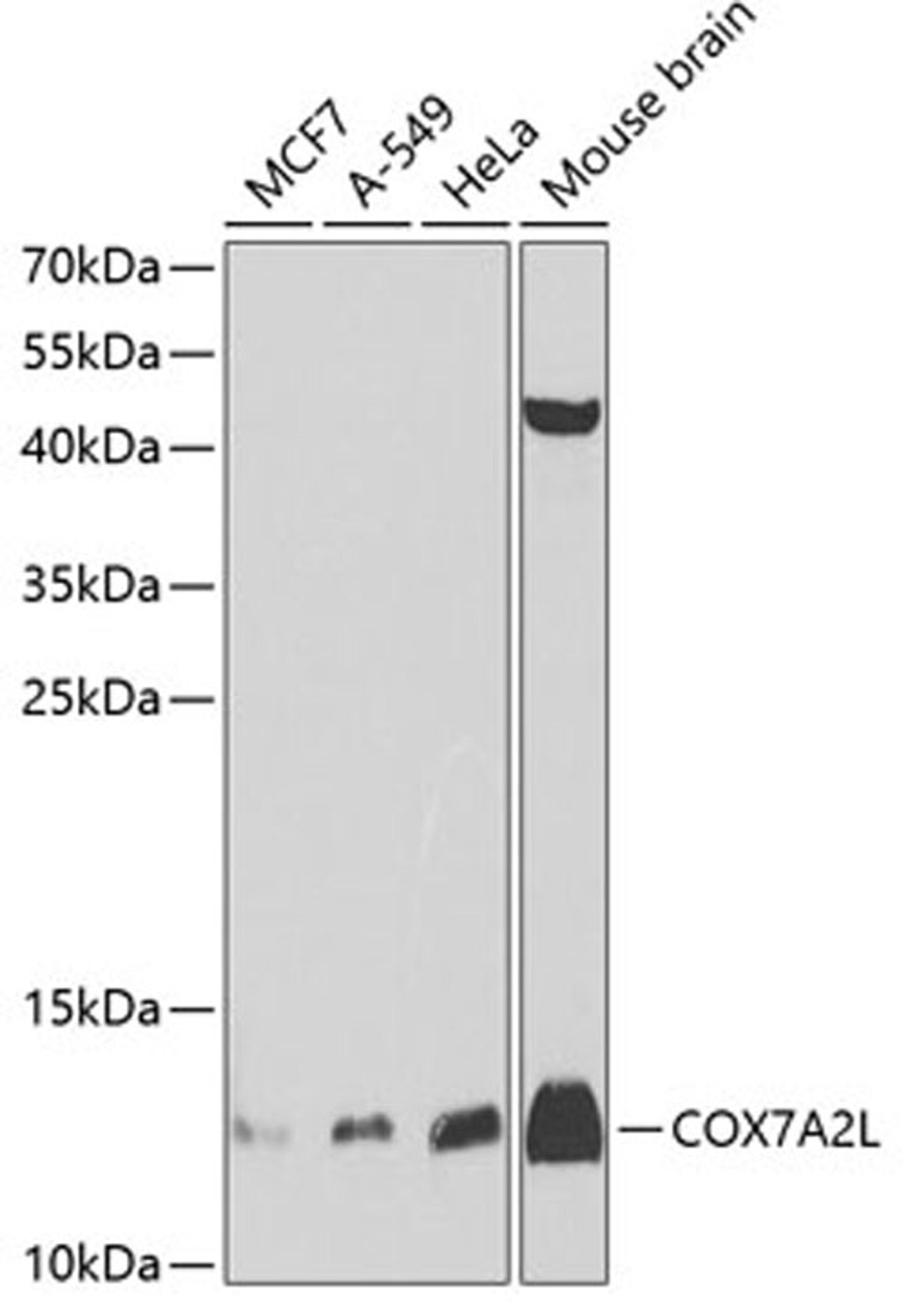 Western blot - COX7A2L antibody (A8298)