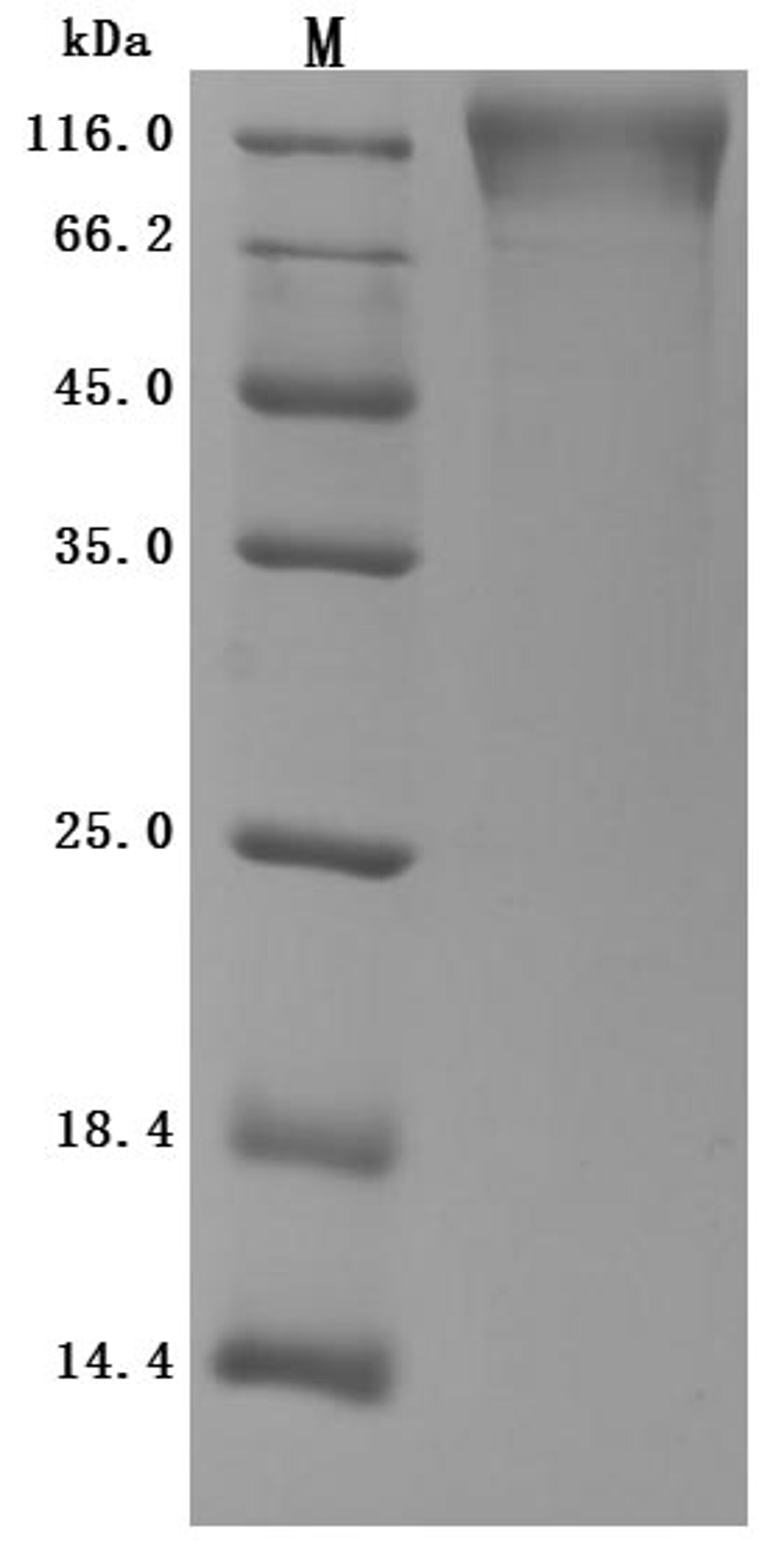 (Tris-Glycine gel) Discontinuous SDS-PAGE (reduced) with 5% enrichment gel and 15% separation gel.