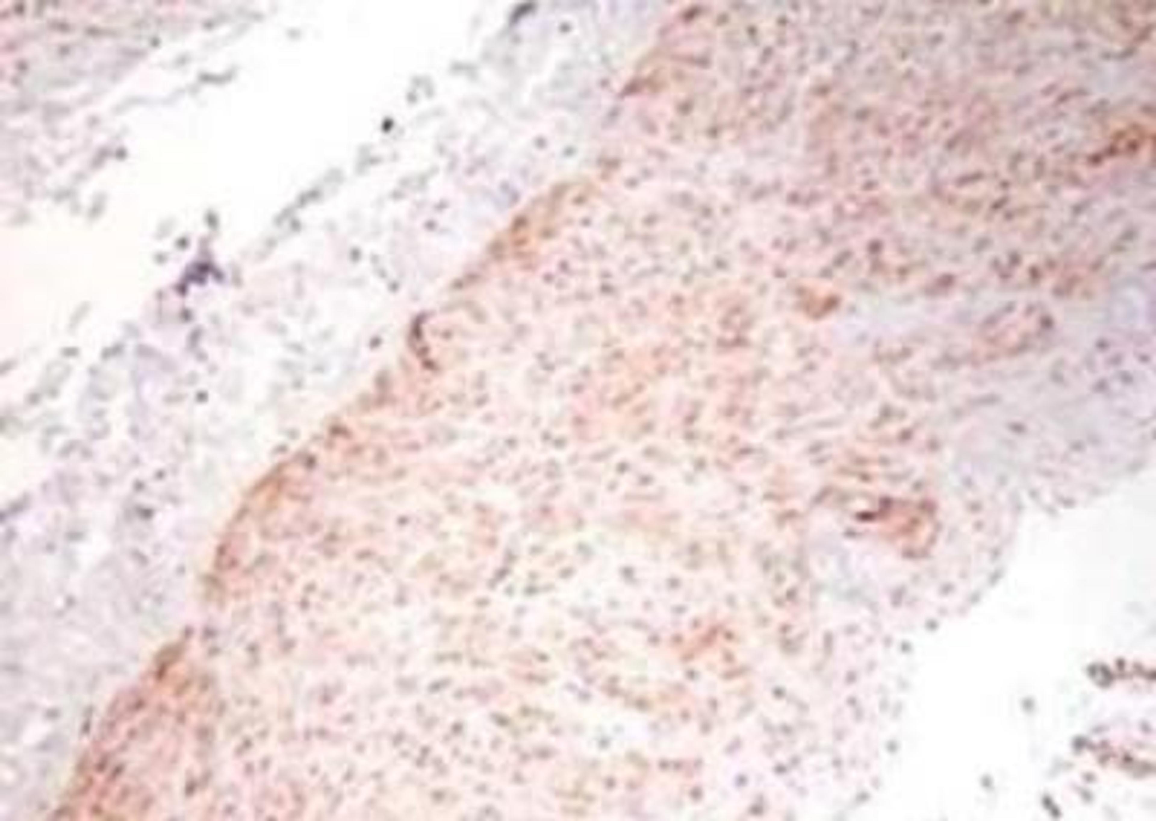 Immunohistochemistry-Paraffin: TNF-alpha Antibody [NB600-587] - Paraffin-embedded sections of human artery tissue sections.