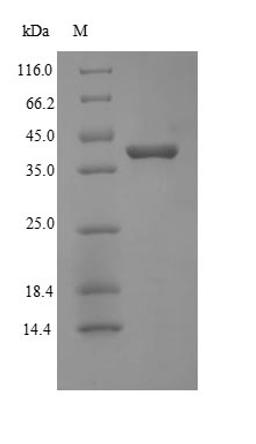 (Tris-Glycine gel) Discontinuous SDS-PAGE (reduced) with 5% enrichment gel and 15% separation gel.
