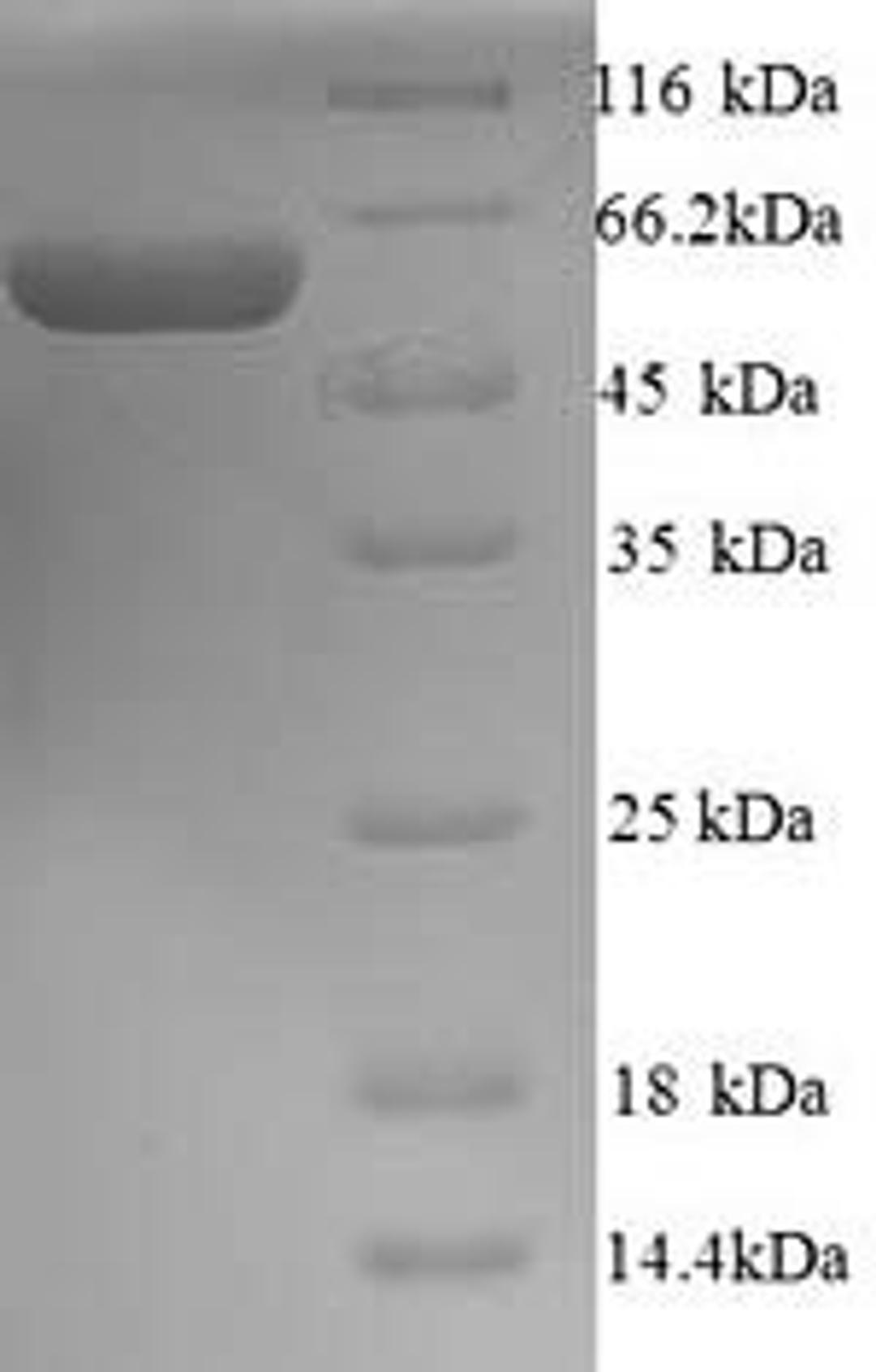 (Tris-Glycine gel) Discontinuous SDS-PAGE (reduced) with 5% enrichment gel and 15% separation gel.