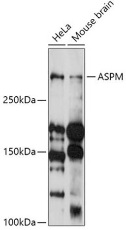 Western blot - ASPM antibody (A18147)