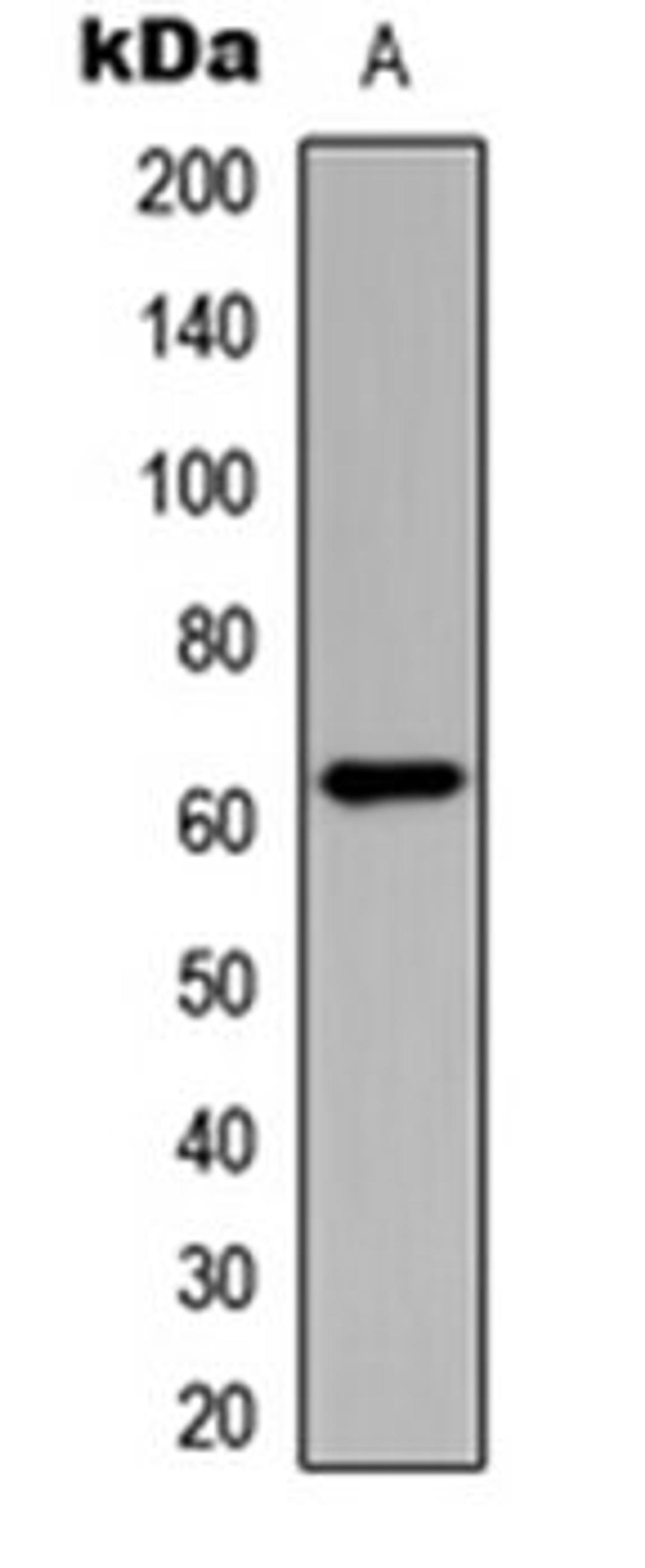 Western blot analysis of HeLa (Lane 1) whole cell lysates using CHK2 (phospho-T383) antibody