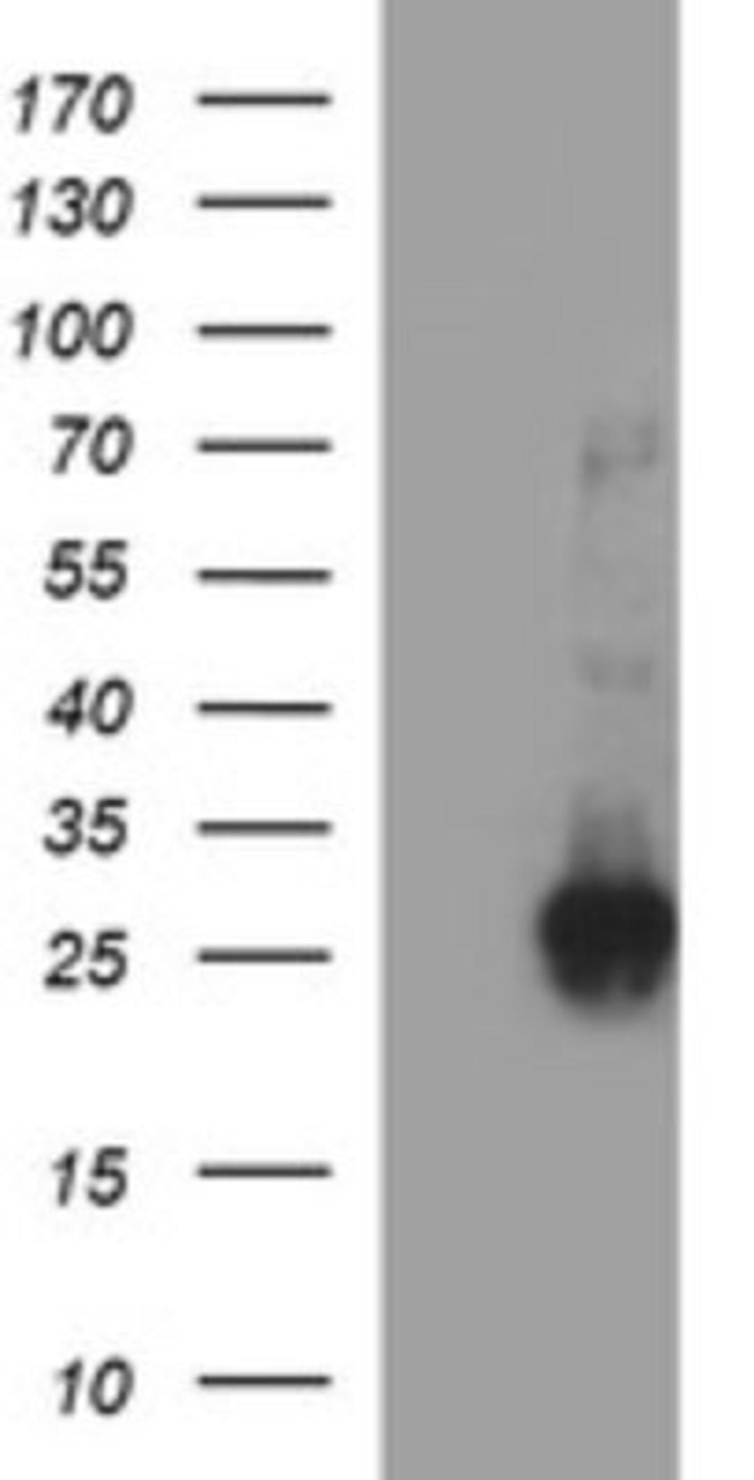 Western Blot: CHAC1 Antibody (1E2) [NBP2-46273] - Analysis of HEK293T cells were transfected with the pCMV6-ENTRY control (Left lane) or pCMV6-ENTRY CHAC1.